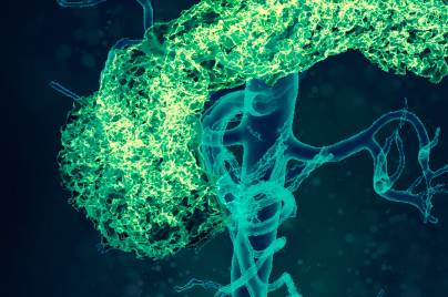 Oncologie