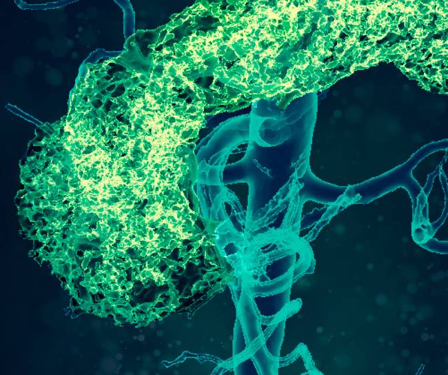 Pancreas and aorta, 3D CT scan