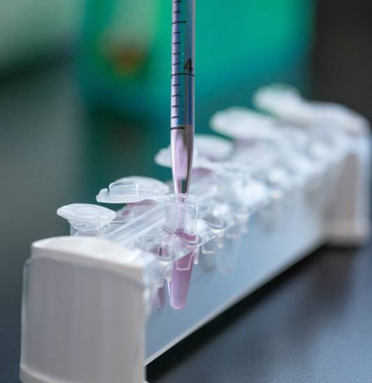 Lab-Equipment-SSF-Measuring pipette-346-1-HI