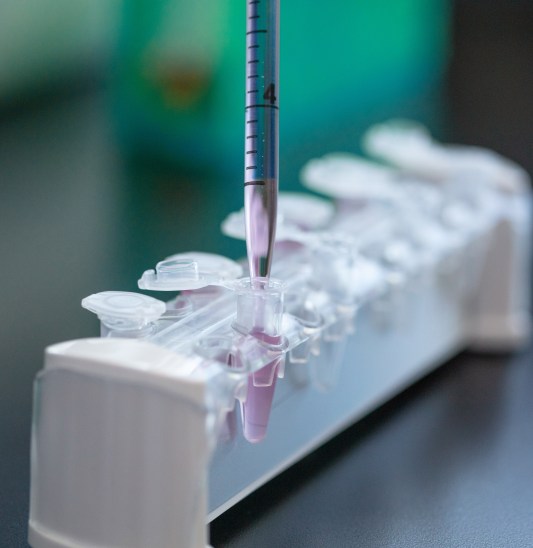 Lab-Equipment-SSF-Measuring pipette-346-1-HI